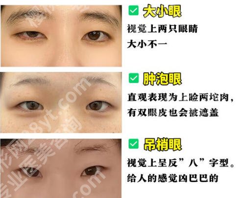 蚌埠第三人民医院割双眼皮好吗?项目推荐和科室实力分析