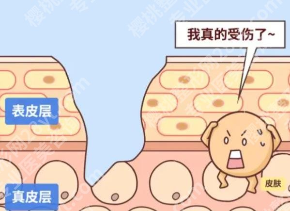 金华中心医院祛疤多少钱?去医院要准备多少预算?2026-8月更新价