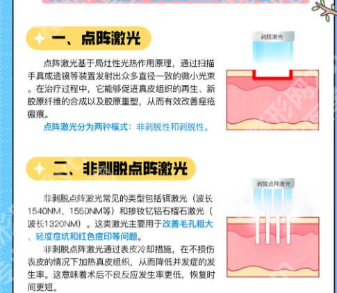中山第二人民医院激光点阵怎么样?看医院专业团队介绍