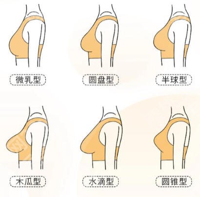 上海第十人民医院隆胸价格表更新!2026客户口碑真实附上!