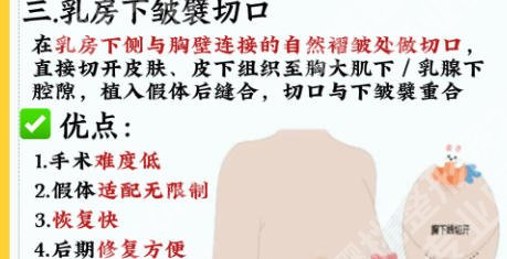 上海第十人民医院隆胸专家怎么样?医生详解与案例分析