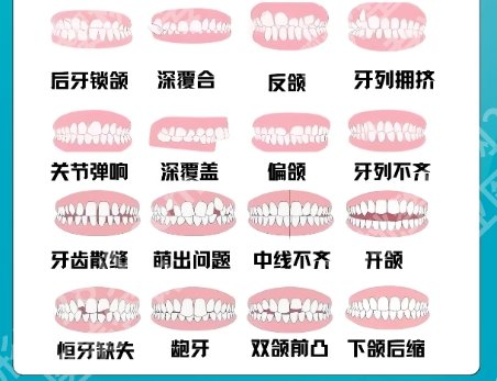 上海华山医院正颌手术价格表公布!颏成形术1万5左右起!含医院简介