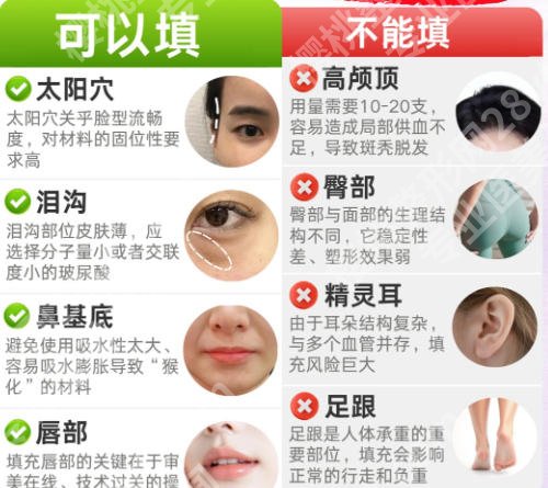 中山一院整形外科与南方医院整形科?两家医院技术实力对比!