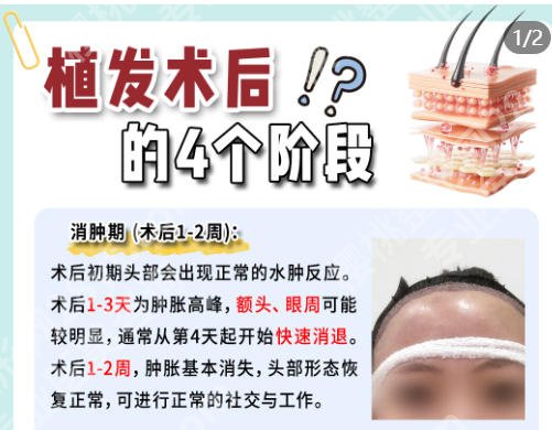 南阳市中心医院植发怎么样? 植发技术实力、价格透明度来袭!