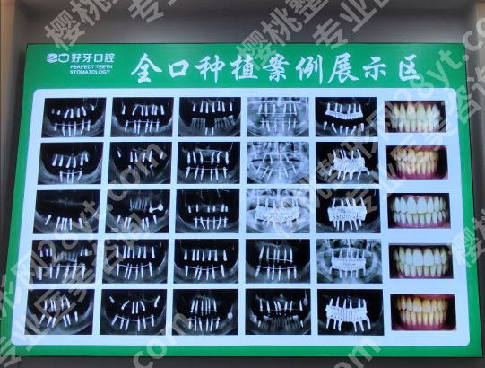 北京看牙去哪儿靠谱？好牙口腔：正规连锁，品牌直供种植体，省钱又放心