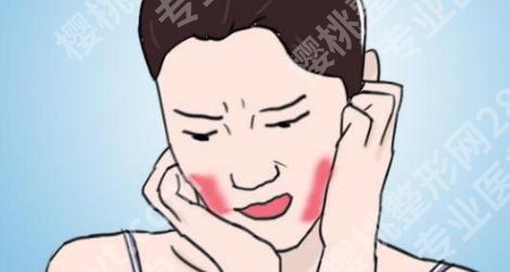 脸部皮肤过敏是怎么回事？科普知识！一目了然！