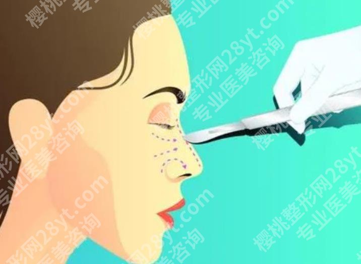 成都成美整形医院是三甲公立吗?医院医生介绍！真实案例分享！