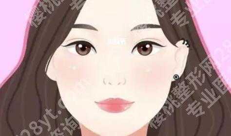成都成美整形医院怎么样?医院医生介绍！真实案例分享！