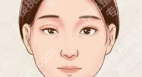 成都天使之翼王琰医生如何？医院医生详细介绍！真实案例分享！