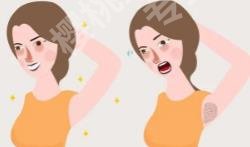 腋下有异味怎么办?科普知识！术前必看！