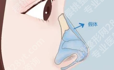 成都维蜜医疗美容评论如何？医院口碑介绍！价格预览！