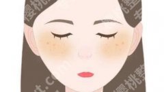 黄褐斑怎么淡化？祛斑方式推荐！价格介绍！