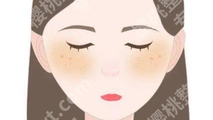 黄褐斑怎么淡化？祛斑方式推荐！价格介绍！