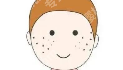 激光祛斑痛吗?科普知识！一看便知！