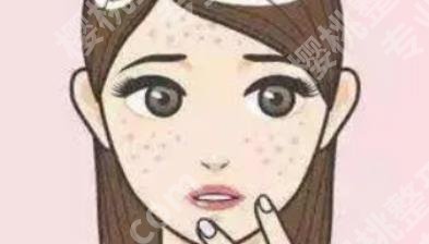 激光祛斑痛吗?科普知识！一看便知！