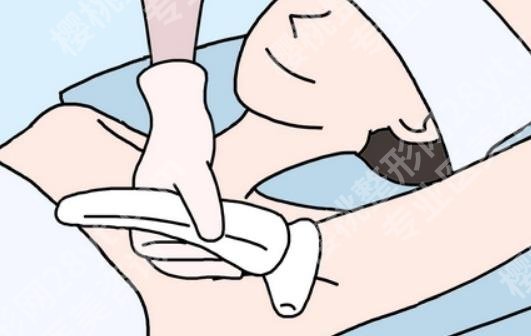 激光脱毛安全吗?科普知识！术前必看！