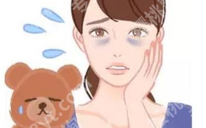 怎么去黑眼圈和眼袋?手术具体事项介绍！术前必看！
