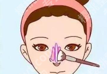 北京俊泰美好医疗美容门诊垫鼻尖多少钱？医院技术如何？价格预览！