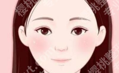 梁伟中双眼皮怎么样？医生技术详细介绍！真实案例分享！