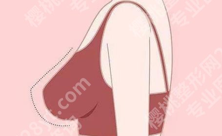 北京艺星隆胸价格如何？医院实力点评！2位医生介绍！