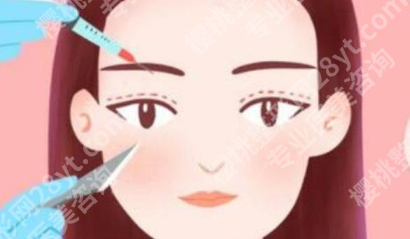 北京叶宇双眼皮医生如何？真实案例分享！一起看看吧！