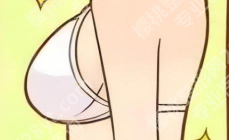 北京韩兴斌隆胸怎么样？医师团队介绍！价格预览！