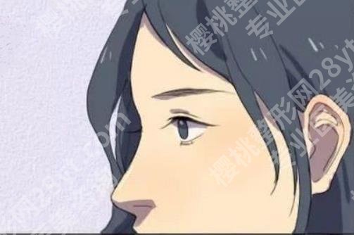 北京八大处做鼻子大概多少钱？2位医生介绍！各有特色！