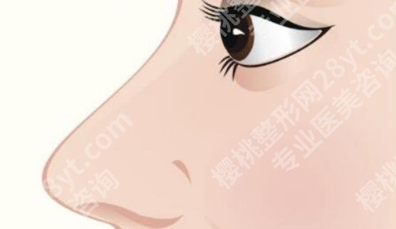 北京米扬丽格医疗美容医院巫医生怎么样？真实案例分享！术前必看！