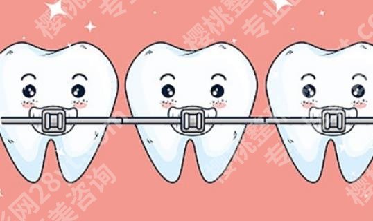北京中诺口腔正畸的费用如何?院内特色项目公开!案例分享!