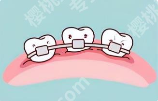 北京中诺口腔正畸的费用如何?院内特色项目公开!案例分享!
