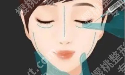 上海欧莱美医疗美容除皱价格?医院实力公开!一起看看吧!