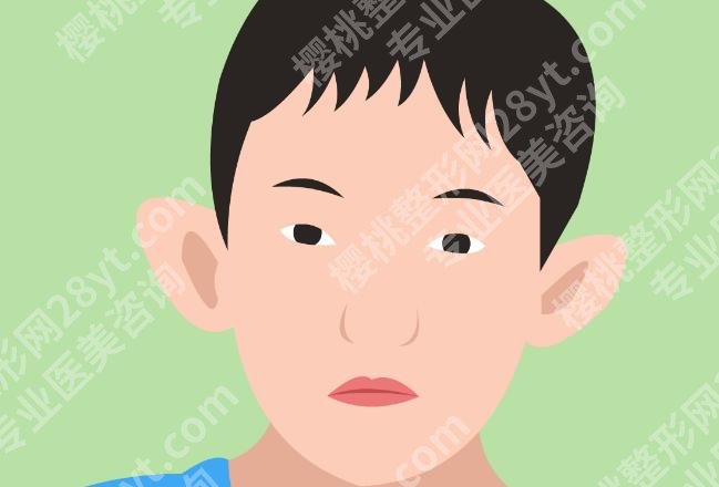 招风耳整形风险大吗？手术价格介绍！项目知识科普！