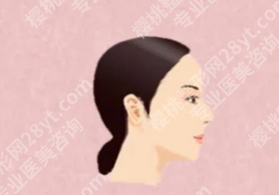 招风耳整形风险大吗？手术价格介绍！项目知识科普！