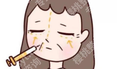 北京玉之光张红芳吸面部脂多少钱？医生技术如何？案例分享！