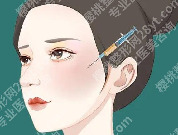 北京张红芳脂肪填充怎么样？医院以及坐诊医生介绍！一起看看吧！