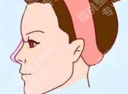 北京美莱叶宇做鼻子怎么样？医院实力点评！赶紧看看吧！
