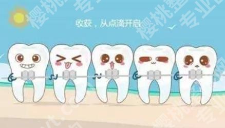 矫正牙齿的佳年龄是多少？时间需要多长？赶紧看看吧！