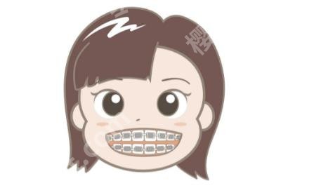 矫正牙齿的佳年龄是多少？时间需要多长？赶紧看看吧！