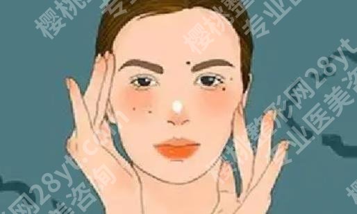激光点痦子会有坑吗？项目原理详细分析！一览便知！