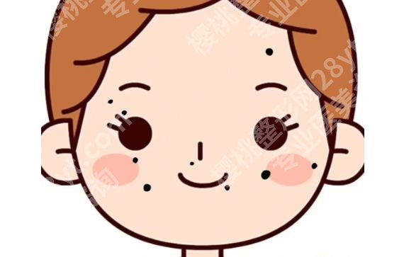 激光点痦子会有坑吗？项目原理详细分析！一览便知！