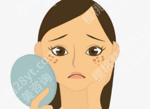 激光点痦子会有坑吗？项目原理详细分析！一览便知！