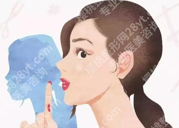 赛诺龙595染料激光价格介绍！术后护理与保养知识科普！