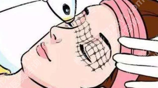 热玛吉全脸做一次多少钱？项目术后注意事项介绍！一览便知！