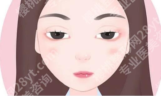 师丽丽内眼角修复案例公开！医院医生实力点评！一览便知！