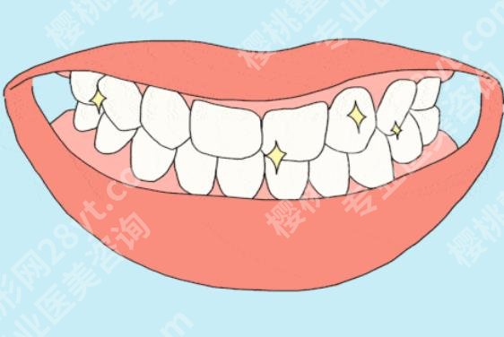 北京金圣口腔诊所牙齿矫正费用如何?科室坐诊医生有哪些?案例分享!