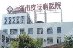 上海雀斑医院哪家好？5家医院介绍！各有特色！