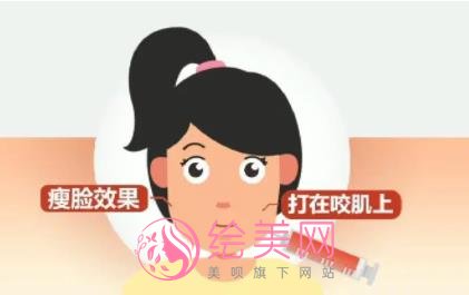注射瘦脸多久打一次？注射瘦脸的优势有哪些？附注意事项