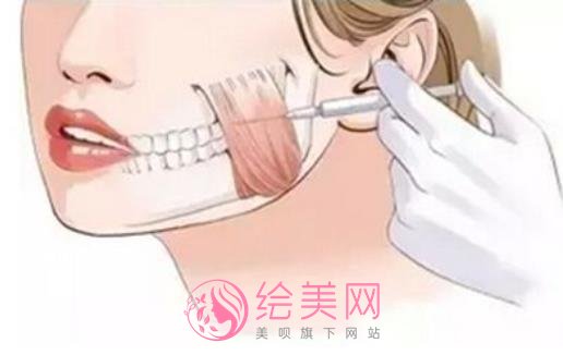 注射瘦脸多久打一次？注射瘦脸的优势有哪些？附注意事项