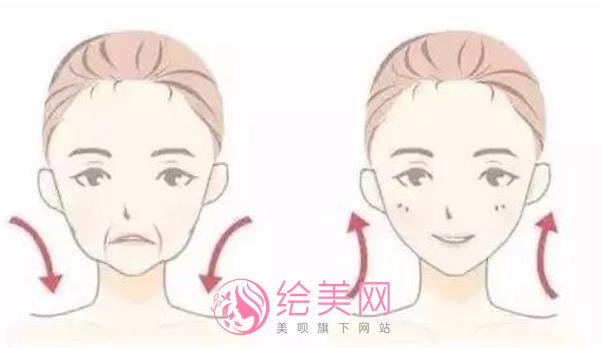热玛吉果好吗？热玛吉项目副作用及风险介绍！戳进来看详情