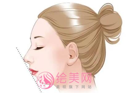 网红脸被老板砸坑索要10万元|漂亮的玻尿酸额头一去不复返！看看怎么回事